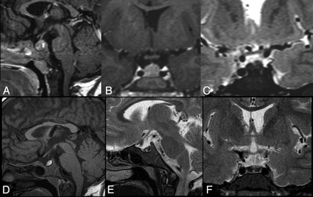 Fig 2.