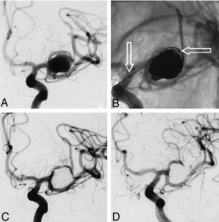 Fig 2.