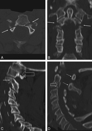Fig 2.