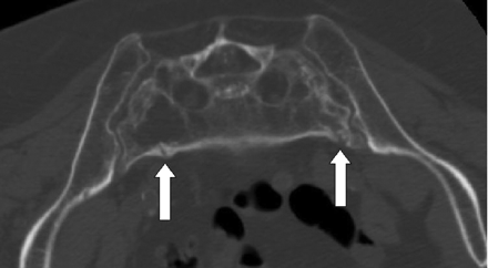 Fig 1.