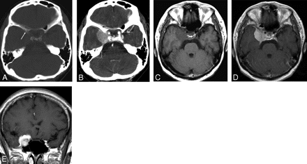 Fig 2.