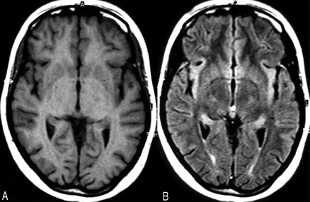 Fig 2.