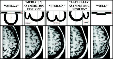 Fig 1.
