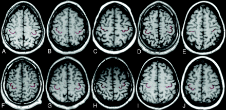Fig 2.