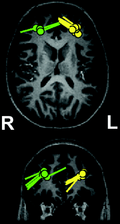 Fig 1.