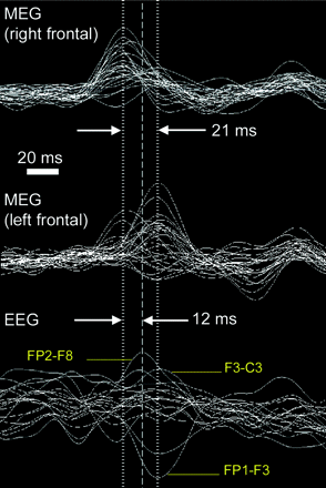 Fig 2.