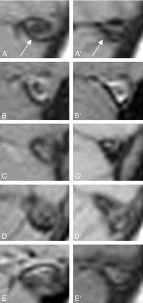 Fig 3.