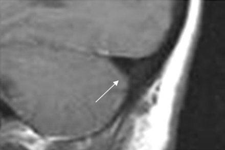 Fig 4.