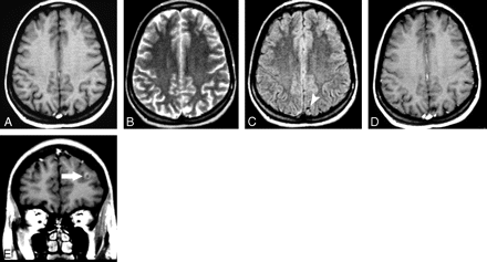 Fig 1.