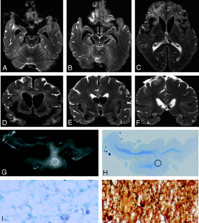 Fig 3.