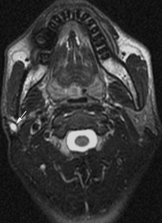 Fig 2.