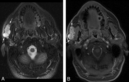 Fig 4.
