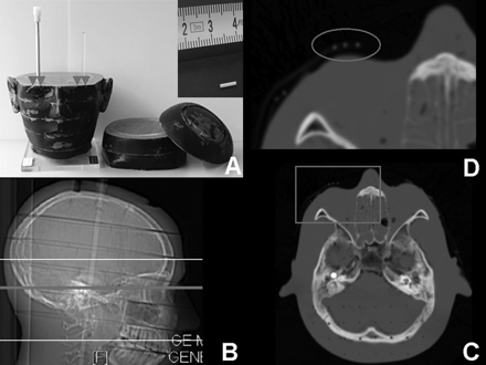 Fig 1.