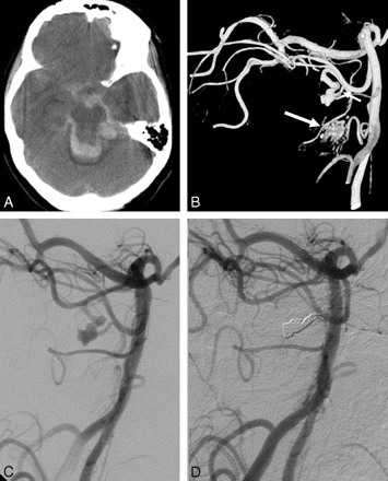 Fig 2.