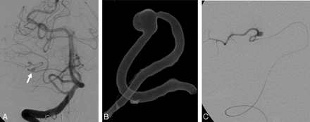 Fig 3.