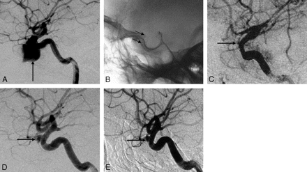 Fig 4.