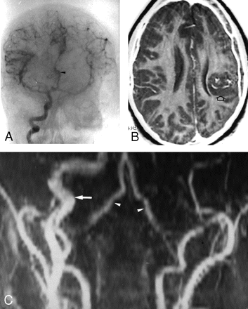 Fig 1.