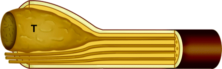 Fig 1.