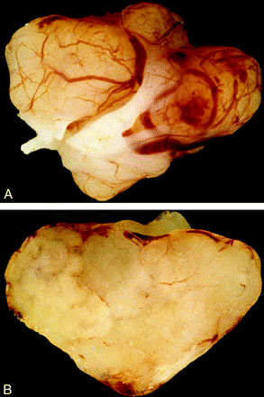 Fig 2.
