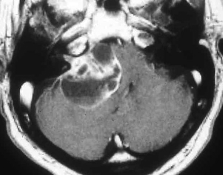 Fig 3.