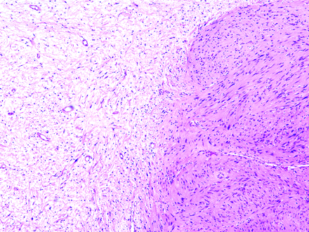 Fig 8.