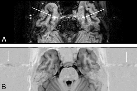 Fig 3.