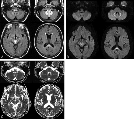 Fig 1.