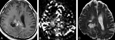 Fig 1.
