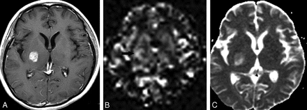 Fig 2.