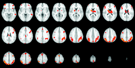 Fig 4.