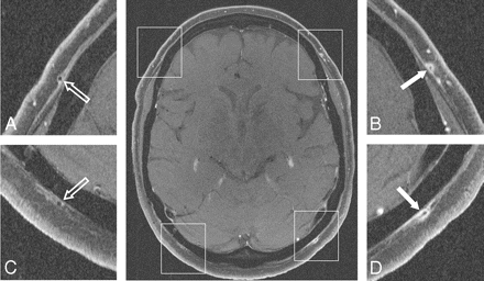 Fig 3.