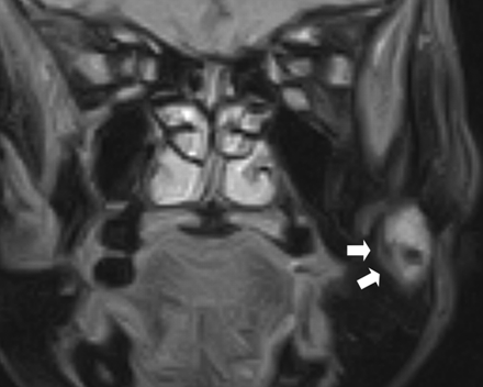 Fig 3.