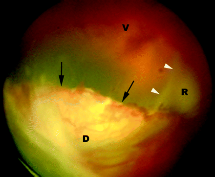 Fig 1.