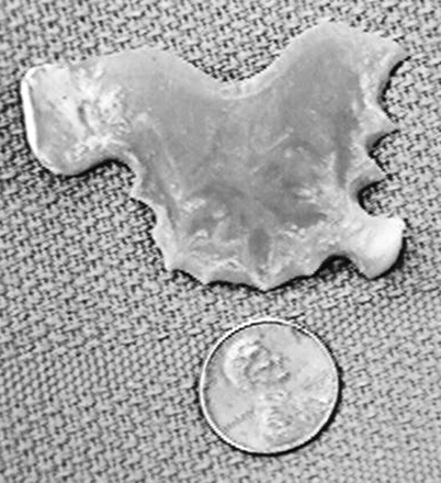Fig 2.