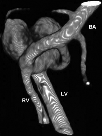 Fig 4.