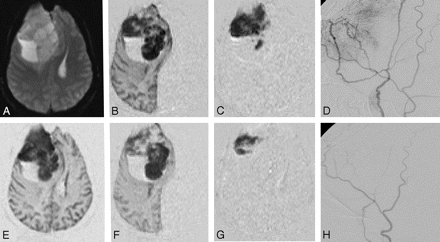 Fig 3.