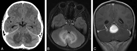   Fig 1. 