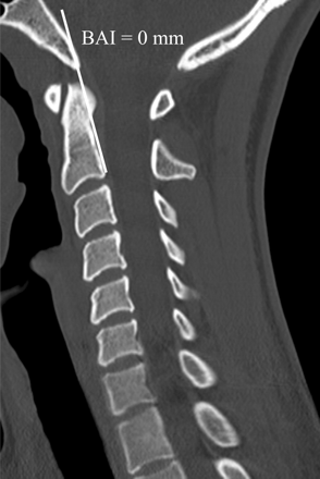 Fig 1.
