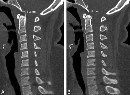 Fig 6.