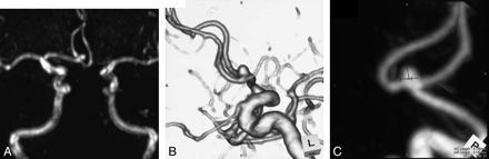 Fig 2.
