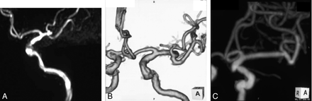 Fig 3.