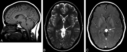 Fig 1.