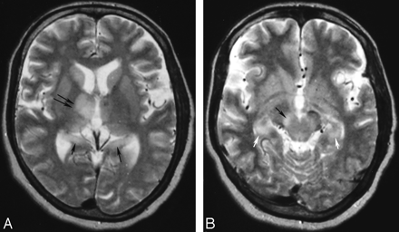 Fig 4.