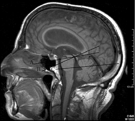 Fig 1.