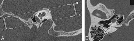Fig 2.
