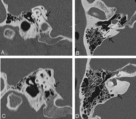 Fig 4.