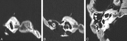 Fig 4.