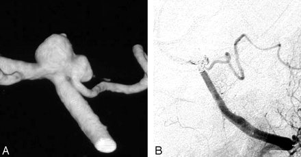 Fig 4.
