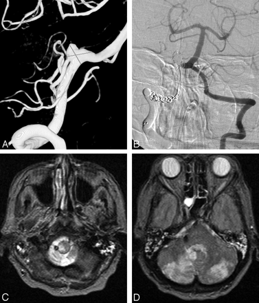 Fig 6.