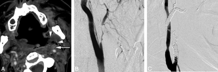 Fig 6.